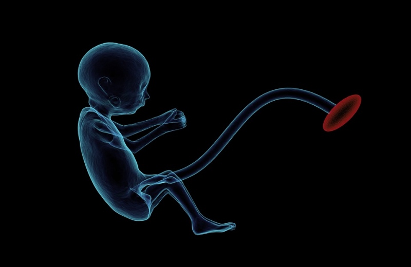 什么是胎儿腹水产生了胎儿腹水后应该怎么办